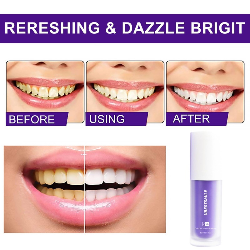 Purple Teeth Whitening Toothpaste Toothpaste 1 Piece White Teeth Whitening