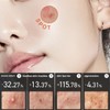 Anua Heartleaf Centella Red Spot Cream 30g