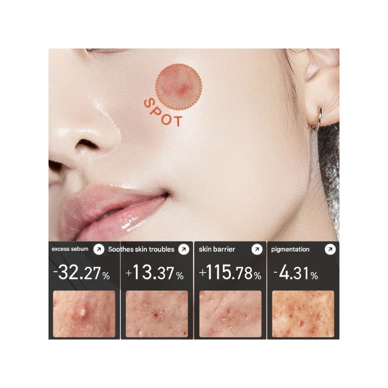 Anua Heartleaf Centella Red Spot Cream 30g