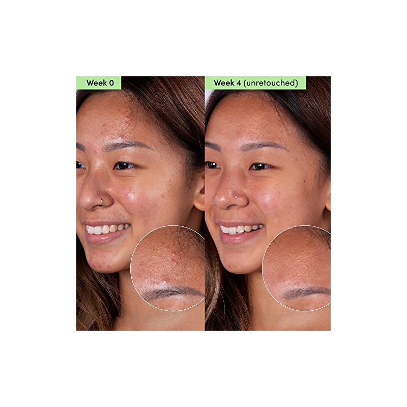 Sand Sky Mascarilla Facial Limpiadora De Control De Aceite