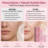 New PDRN Pink Collagen Volume Multi Balm Stick – Hydrates