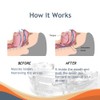 Anti Snoring Devices, Effective Snoring Solution, Adjustable and Reusable Stop