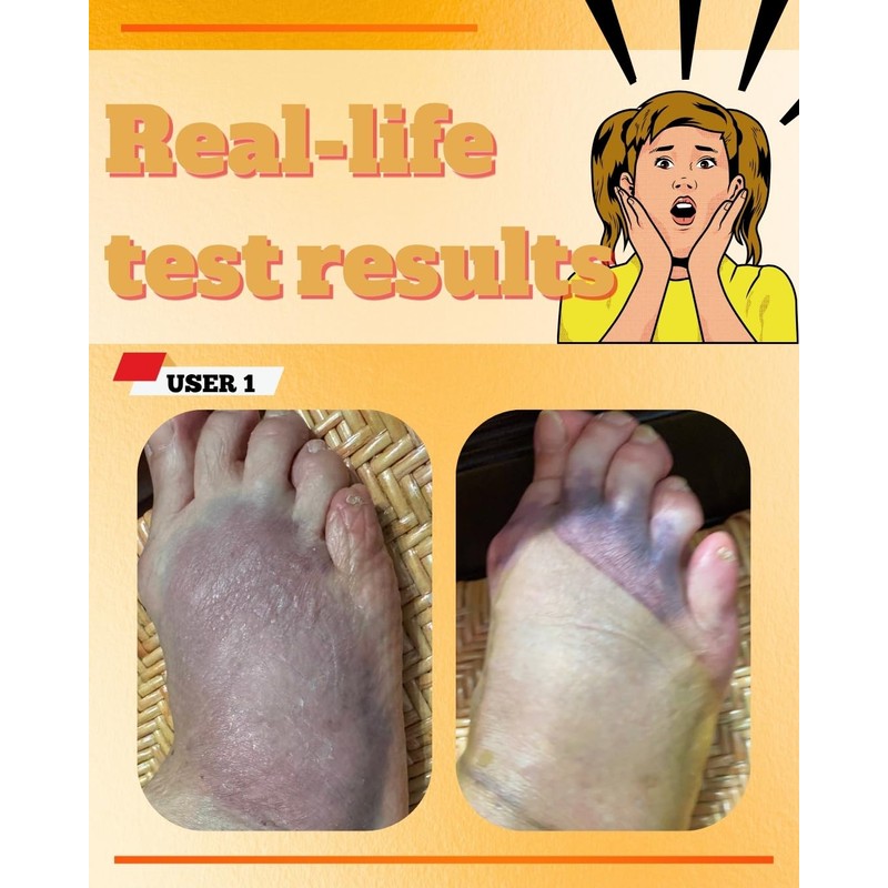 Amor Turmeric & Curcumin Topical Patch – Natural Botanical Formula