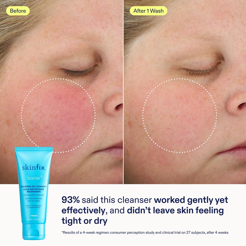 Skinfix Barrier+ Better Skin Starts Here Kit - Includes Mini