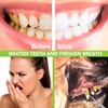 PARYUNGR Dental Tools, Professional Teeth Cleaning Oral Care Hygiene Kit,