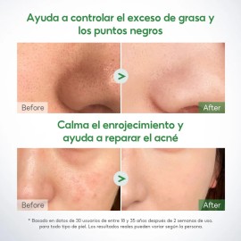 Papa Feel Mascarilla Facial Mugwort 55g Control Acn - Todo Tipo De Piel                                                                               