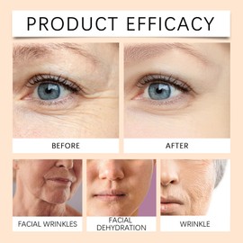 Eazerom 11 Vitamin C Serum mit Hyaluronsäure für Gesicht,30ml Brightening & Hydrating Facial Serum for Fine Lines,Anti Aging FaceSerum für alle Hauttypen Geeignet,Anti-Aging