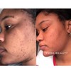 Turmeric Serum, Dark Spot Remover, Flawless Face Serum, Even Glowing