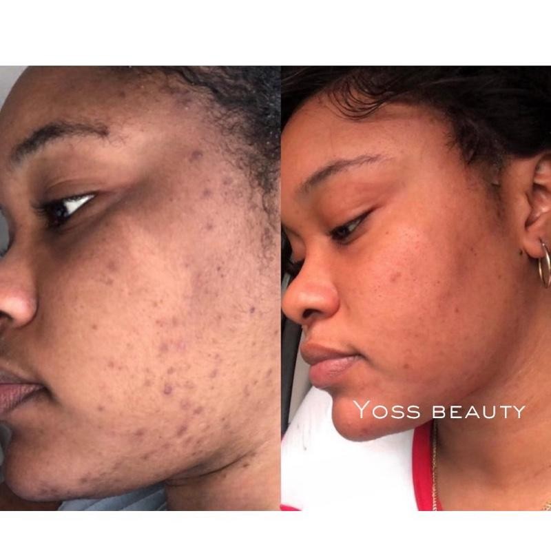 Turmeric Serum, Dark Spot Remover, Flawless Face Serum, Even Glowing