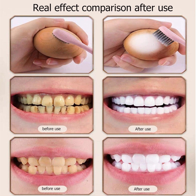 💯Original Bodyaid Niacinamide Whitening Toothpaste Teeth Whitening Ubat Gigi Bodyaid