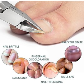 Cortaúñas Biselado, 2 PCS Manicura de pico de águila Nail Clippers, Afiladas y Cortaúñas Robustas, Con limas y Herramientas de Corte de uñas, Manicura Ergonómica con Contenedor de Recogida