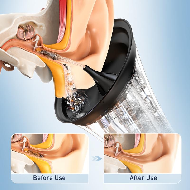HeaDot Electric Ear Wax Removal - Water Spray,Rechargeable,Temp Detection,IPX7 Waterproof,Effective