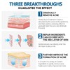 No Brand Real and effective Acne Pimple Cream 祛痘膏祛痘乳霜 20g