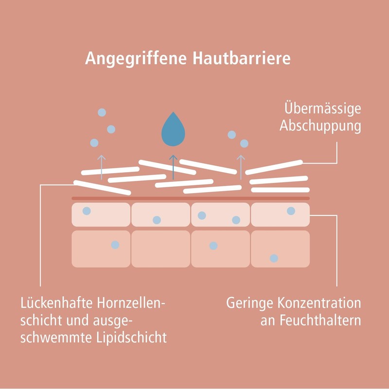 VICOPURA REPIDOUX Intensiv-Creme, 50ml, Hornhautcreme zur Pflege rauher, verhornter Haut