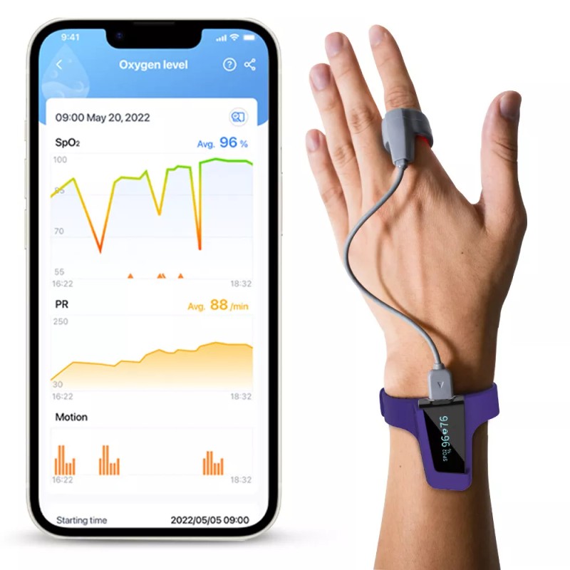 Wellue O2 Sensor Ring for Wellue Pulse Oximeter SleepU, Visual