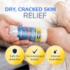Dr. Scholl's Bálsamo reparador de talón agrietado, 2.5 onzas, con