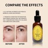 Frankincense Resin Oil for Face, Frankincense Oil for Skin, Frankincense