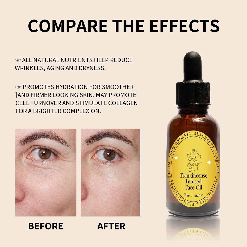 Frankincense Resin Oil for Face, Frankincense Oil for Skin, Frankincense
