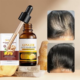 Ginger Anti-Hair Loss Oil and Shampoo, Hair Growth Serum Set, Ginger Extract Anti-Hair Loss Treatment Essence Set for Thicker, Stronger, Longer for Men and Women (1)