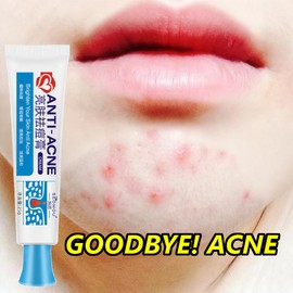 No Brand Real and effective Acne Pimple Cream 祛痘膏祛痘乳霜 20g Natural Face Creams Moisturizer Acne Treatment Gel for Skin Repairing