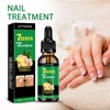 2PCS Ginger Nail Treatment, Cuticle Care Oil for Nails,Nail Nail,