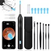 Ear Wax Removal Cleaner with Camera: Favofit Earwax Otoscope with