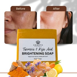 Turmeric Skin Cleansing Soap - Natural Glow Face & Body Cleanser for Acne, Dark Spots & Scars, Gentle for All Skin Types (4.5 oz) 1 bar