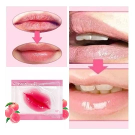 Molin Pack 10 Parches Colágeno Labios Hidrogel