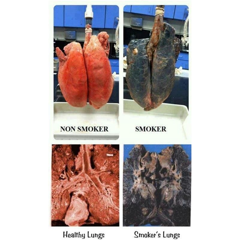 NaturalyPure Lung Harmony - Serious Support for Clear Breathing. Lung