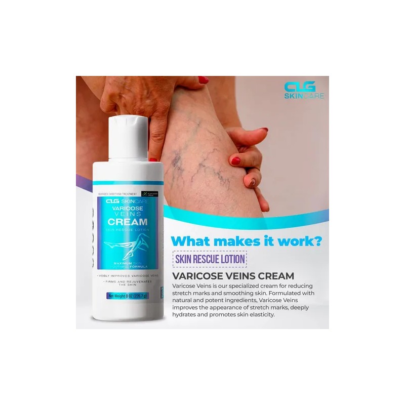 Clg Skincare - Crema Para Venas Varicosas, Loción De Rescate