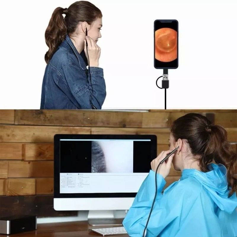 Dahua Cámara Endoscopio Wifi De Oídos, Otoscopio Con 6 Led's