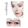 Crema Para Ojos Bioaqua Quita Ojeras Todo tipo de piel