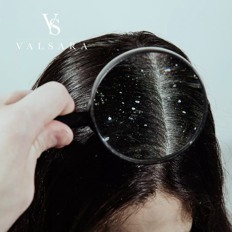 Sands Care 5 Pz Jabón Artesanal Alquitrán Hulla (psioriasis,caspa) 100g