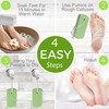 Dr. Entre's Pumice Stone for Feet 4 Pack: Callus Remover,