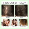 Champú para el crecimiento del cabello de romero,engrosamiento (5pcs)