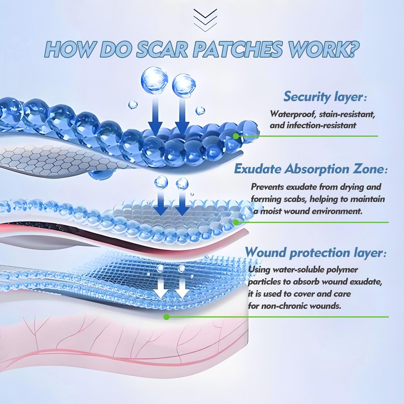 Rayyl Silicone Scar Sheets (1.6" x 60" Roll - 1.5M)