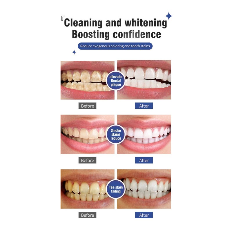 2PCS SP-6 Ultra Whitening Toothpaste, Fresh Breath, Teeth Whitener, Super