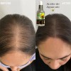 Suero Capilar Kaliya Beauty - Crecimiento Cabello
