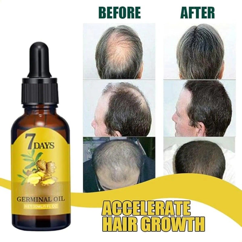 Suero De Jengibre Para El Crecimiento Del Cabello-2 Botellas