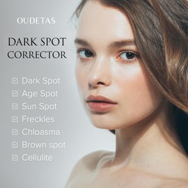 Dark Spot Remover for Face Serum: Remove Sun & Age Spot – Melasma Brightening Cream for Face & Body, Hands & Legs, Brown Skin, Freckles with Roller, Hyperpigmentation Removal Treatment 15ml