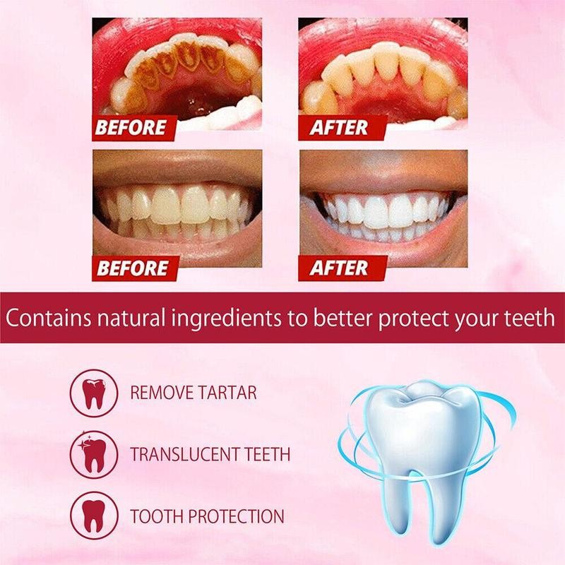YAYASHI SP-4 probiotic toothpaste SP4 toothpaste fresh breath deep cleaning