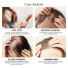 Aceite Para El Crecimiento Del Cabello Belleka Veganic Natur