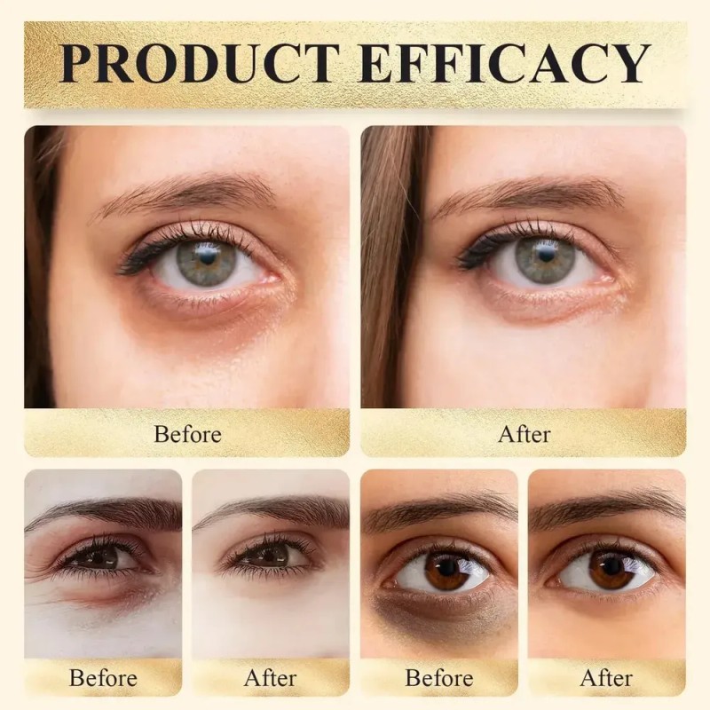 A/ Corrector De Ojos Spf 41, Corrector De Ojeras, Nj