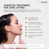 myolift™ Jowl Mask: Microcurrent Technology for Perfect Jawline| Reduces Aging