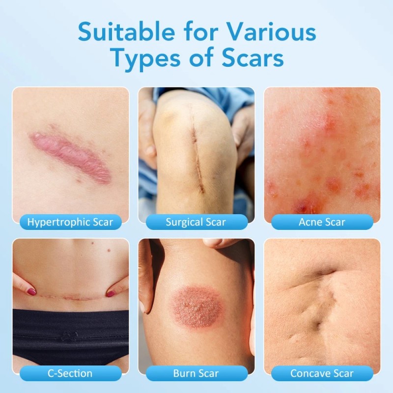 DERMFREE 6x Silicone Scar Sheets Gel Scar Patch Self-Adhesive Scar