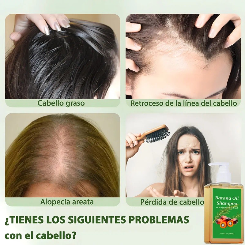 300ml*2pcs Champú Batana, Crecimiento Del Cabello