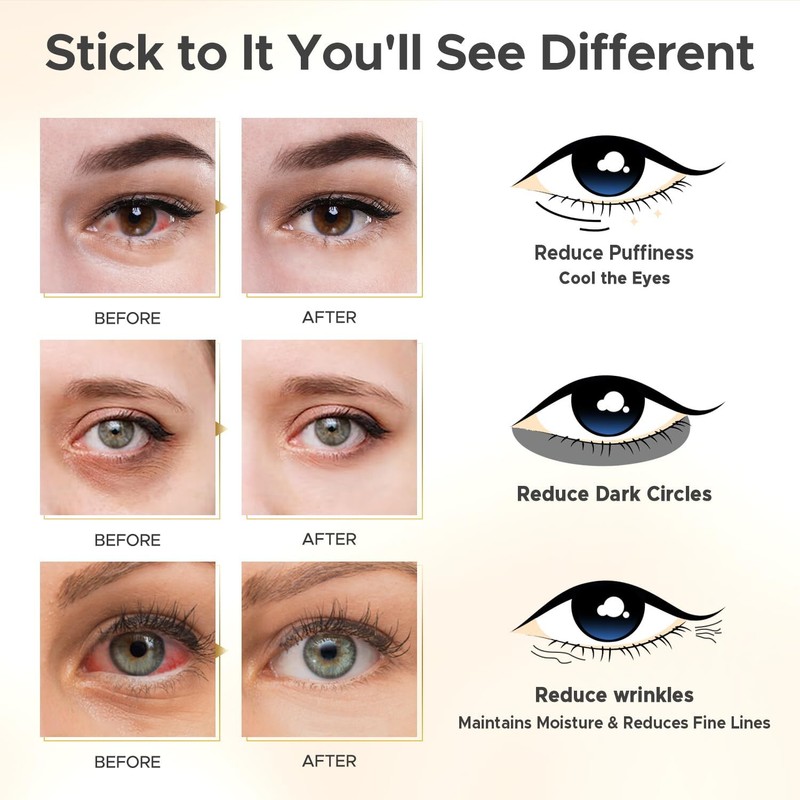 HOPEMATE Under Eye Patches for Puffy Eyes,Dark Circles,Wrinkl