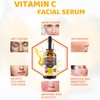 AICHUN BEAUTY 12.5% Vitamin C Face Serum Moisturizing Anti-Freckle Anti-Aging
