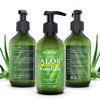 Gel de aloe vera