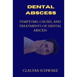 Dental Abscess: Symptoms,Causes And Treatments Of Dental Abscess